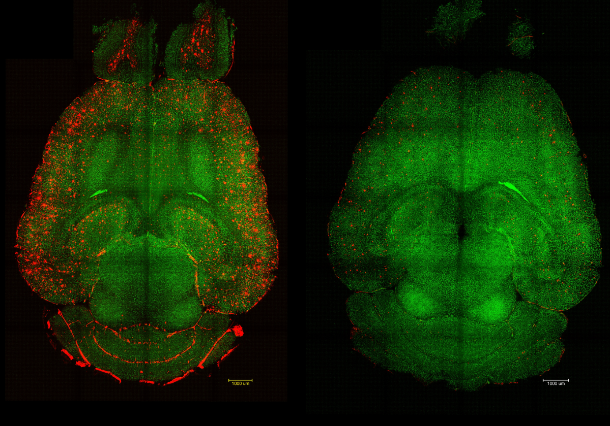 Вчені вилікували Альцгеймера у мишей єдиним уколом