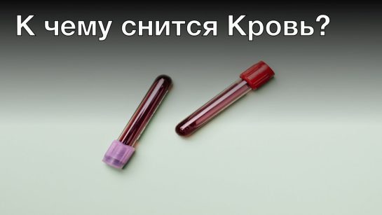 К Чему Снится Кровь: Толкование и Значение Сновидения